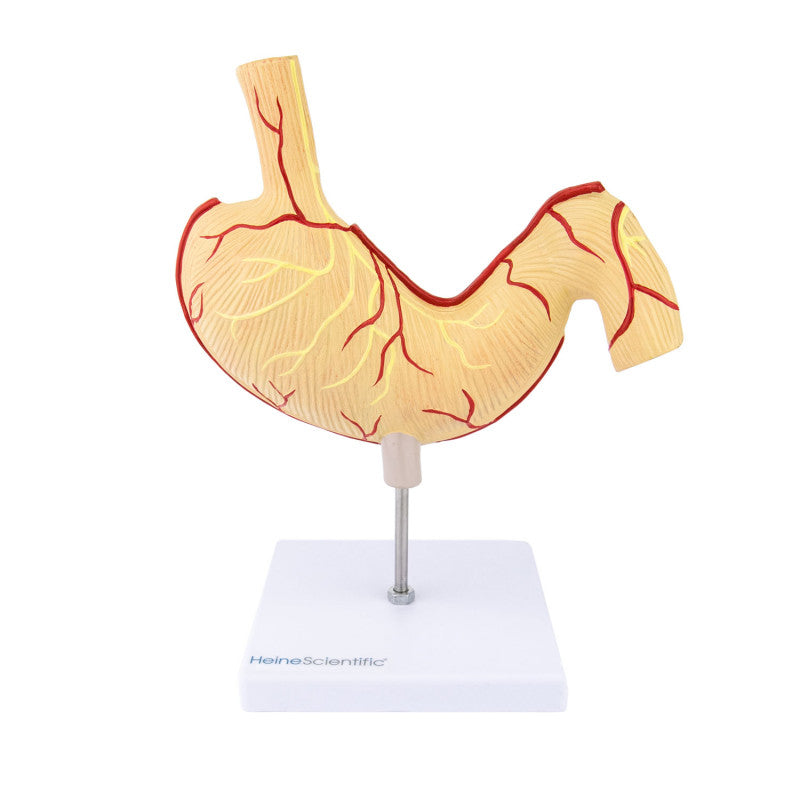 Stomach Model with Ulcers Medvana UK