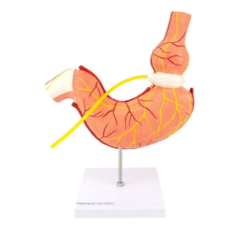 Stomach Model with Gastric Band Medvana UK