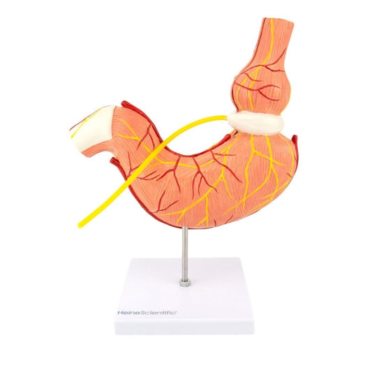 Stomach Model with Gastric Band Medvana UK