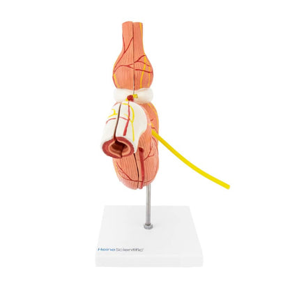Stomach Model with Gastric Band Medvana UK