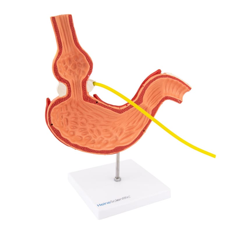 Stomach Model with Gastric Band Medvana UK
