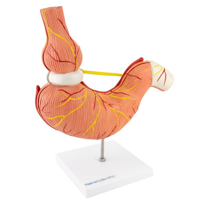 Stomach Model with Gastric Band Medvana UK