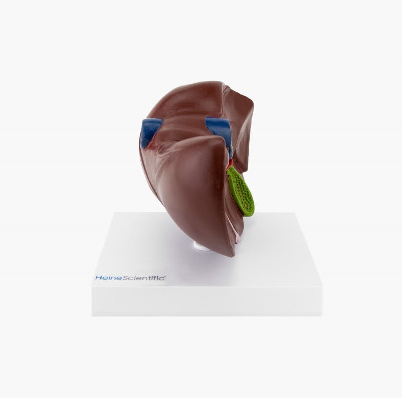 Model of Liver and Gall Bladder Medvana UK