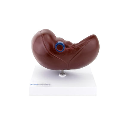 Model of Liver and Gall Bladder Medvana UK