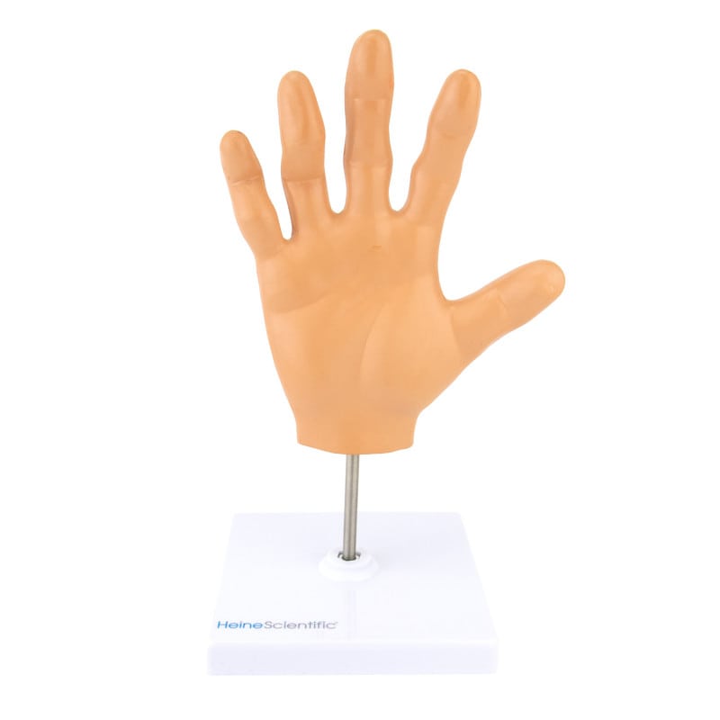Hand Model with Rheumatoid Arthritis Medvana UK