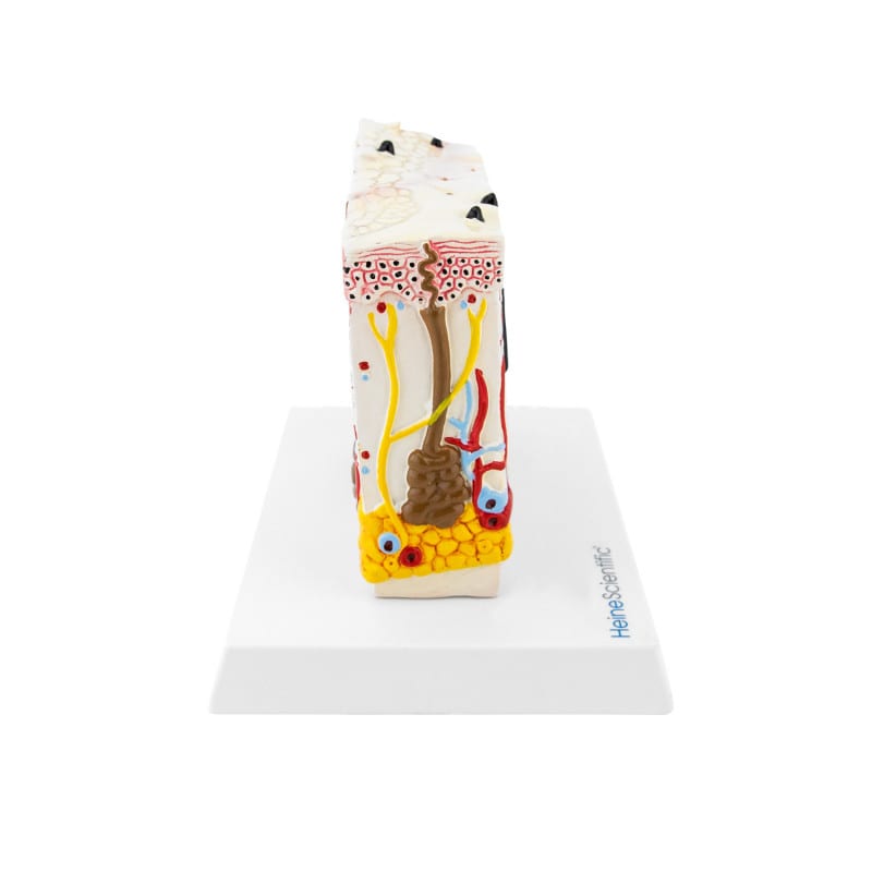 Model Skin with Psoriasis Medvana UK