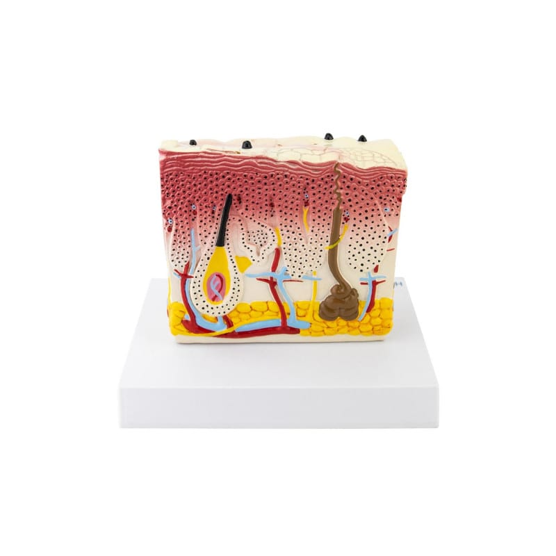 Model Skin with Psoriasis Medvana UK