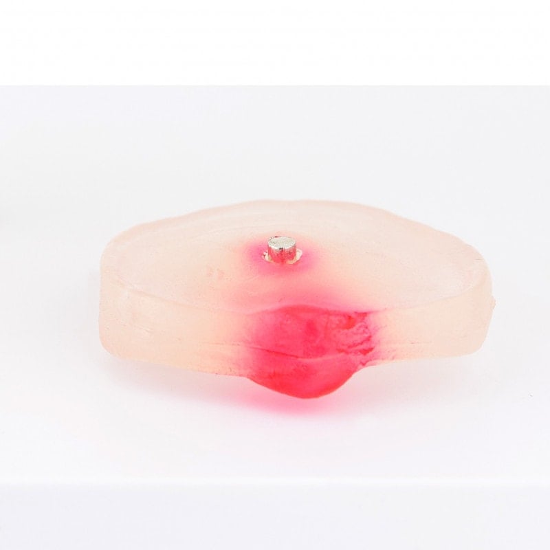 Herniated Disc Model Medvana UK