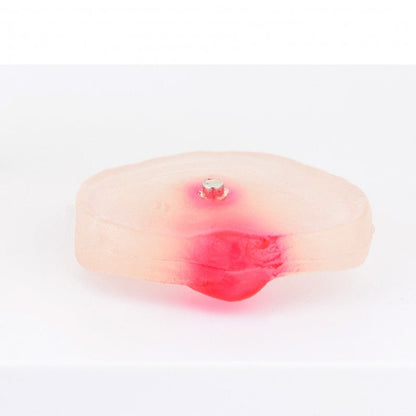 Herniated Disc Model Medvana UK