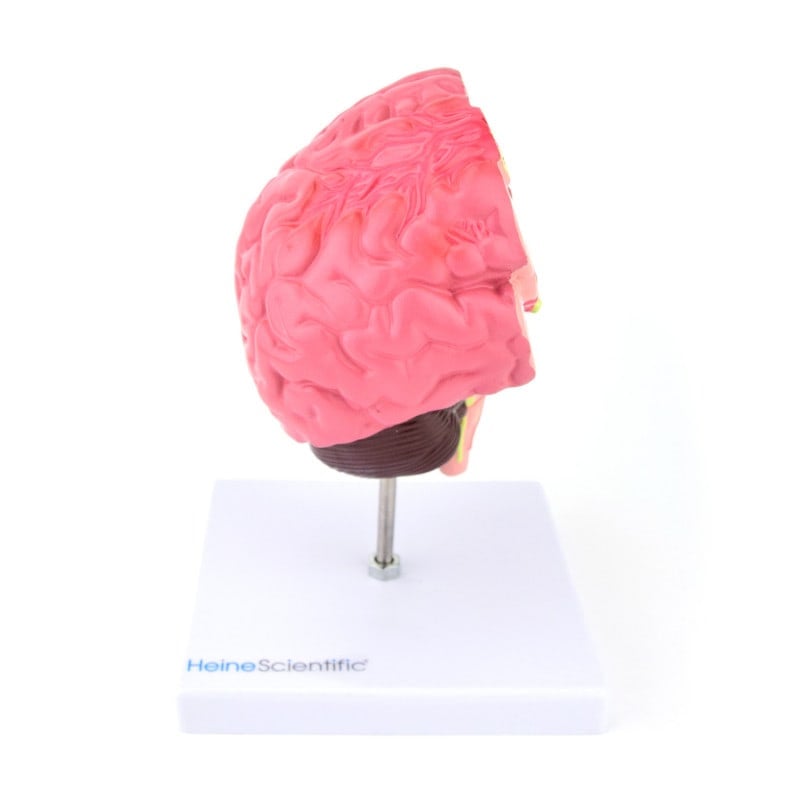 Brain Model with Diseases Medvana UK