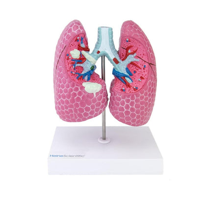 Lung Model with Diseases Medvana UK