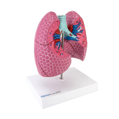Lung Model with Diseases Medvana UK