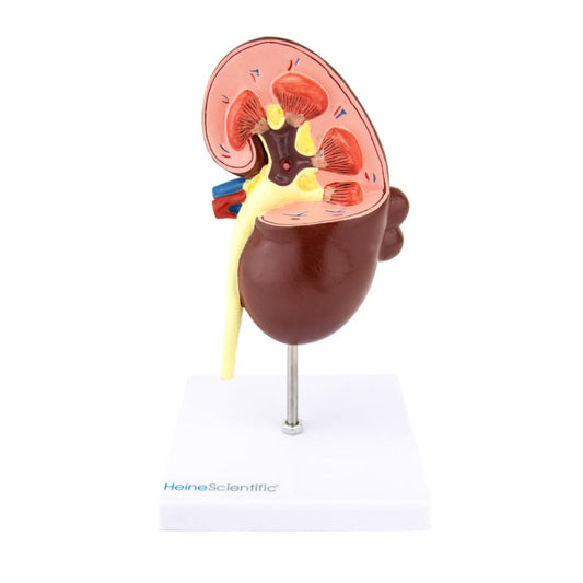 Kidney Model with Diseases Medvana UK
