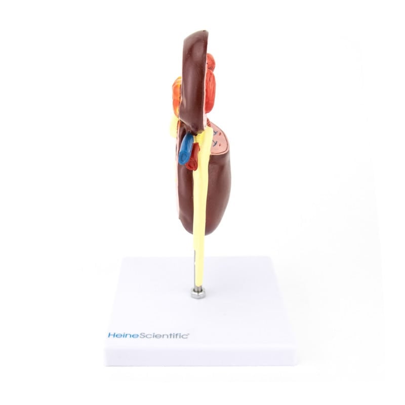 Kidney Model with Diseases Medvana UK