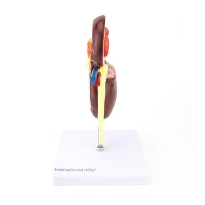 Kidney Model with Diseases Medvana UK