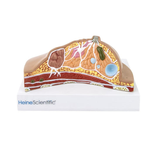 Female Breast Model with Diseases Medvana UK