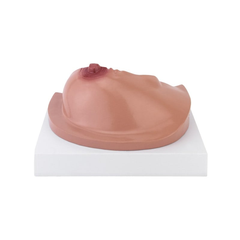 Female Breast Model with Diseases Medvana UK