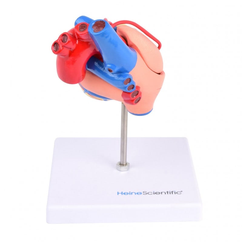 Heart Model with Bypass Medvana UK