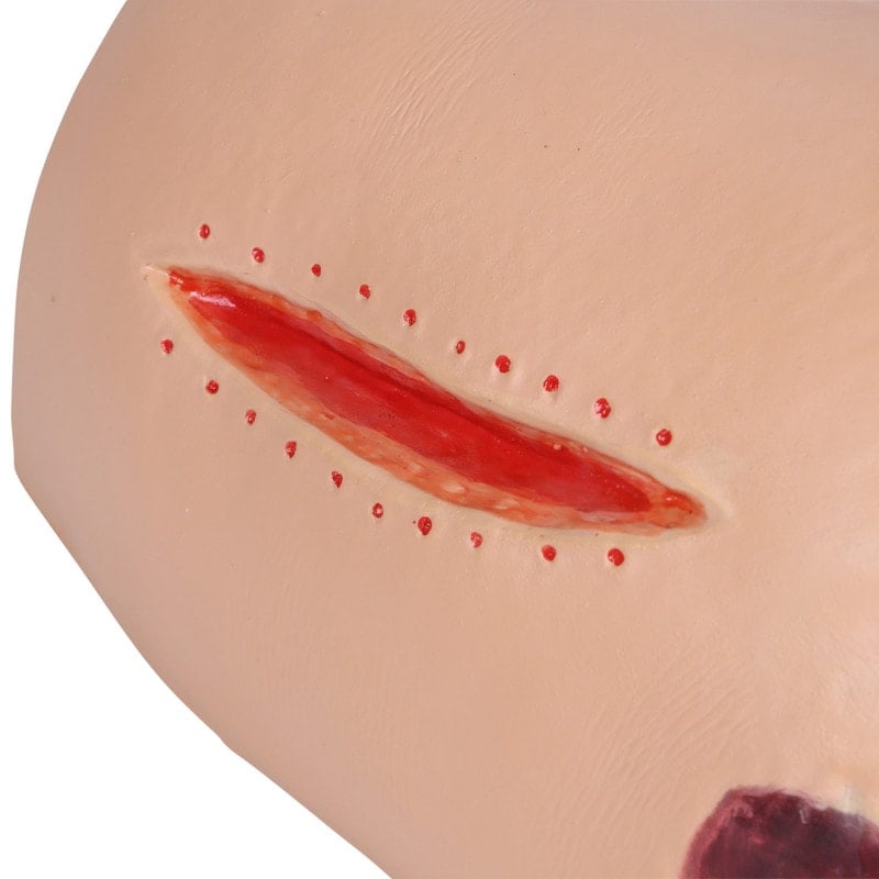 DECUBITUS DAN Treatment Simulator Medvana UK