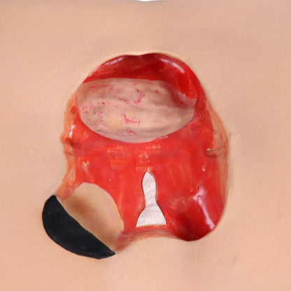 DECUBITUS DAN Treatment Simulator Medvana UK