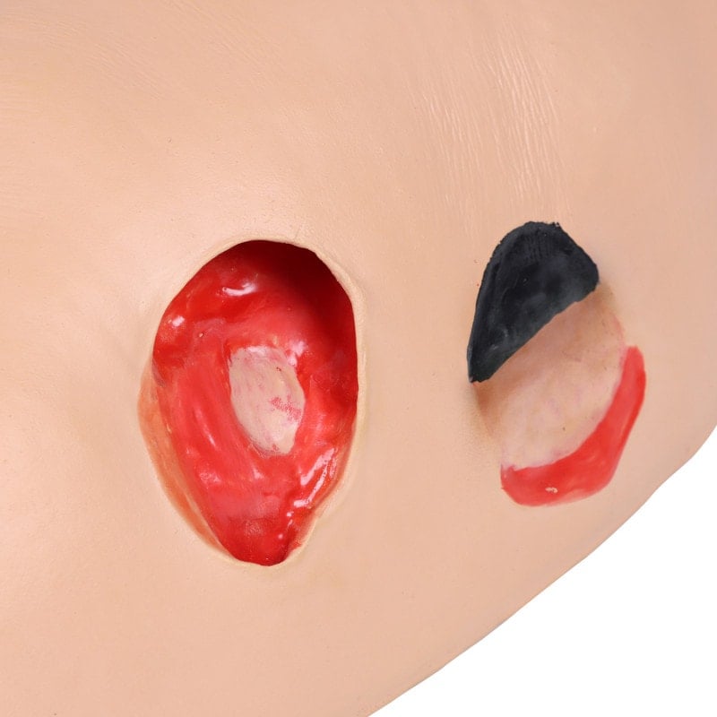 DECUBITUS DAN Treatment Simulator Medvana UK