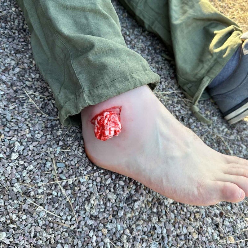 Wound Moulage Open Fracture Ankle
