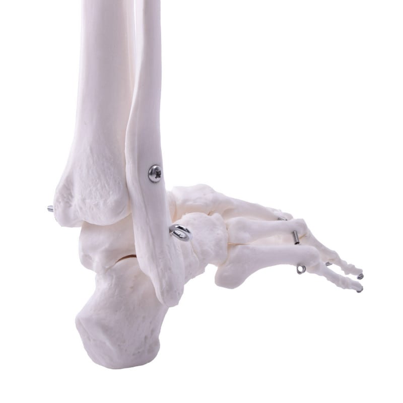 Leg Skeleton Medvana UK