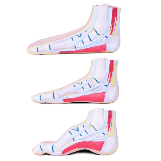 Model of Foot Malpositions Medvana UK