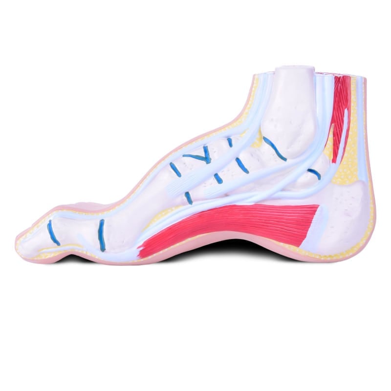 Model of Foot Malpositions Medvana UK