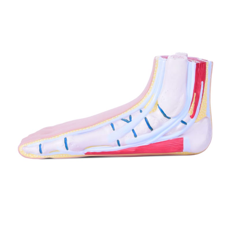 Model of Foot Malpositions Medvana UK