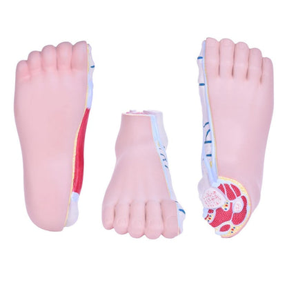 Model of Foot Malpositions Medvana UK