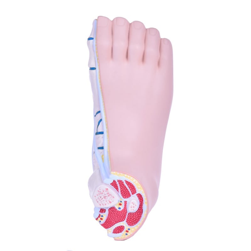 Model of Foot Malpositions Medvana UK