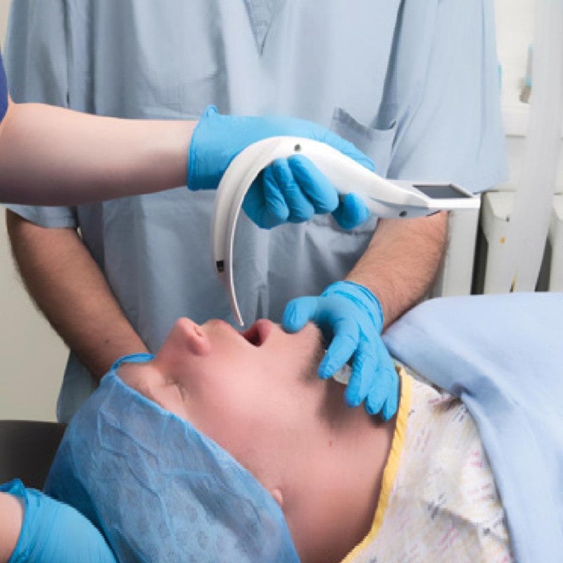 i-view Video Laryngoscope from Intersurgical Medvana UK