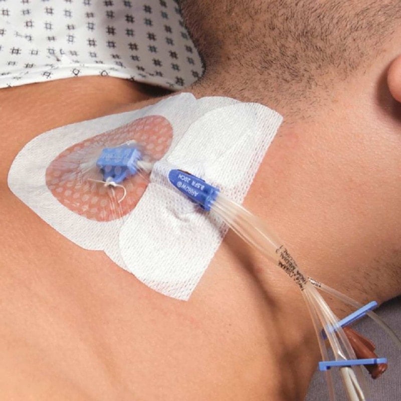 Curafix® i.v. Control Catheter Fixation Dressing Medvana UK