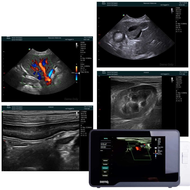 H1300 Portable Ultrasound with convex probe C62B Medvana UK