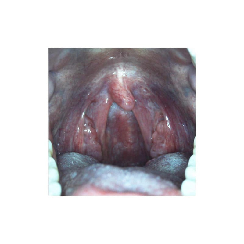 DE605 Examination Camera Medvana UK