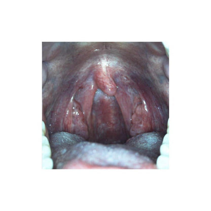 DE605 Examination Camera Medvana UK