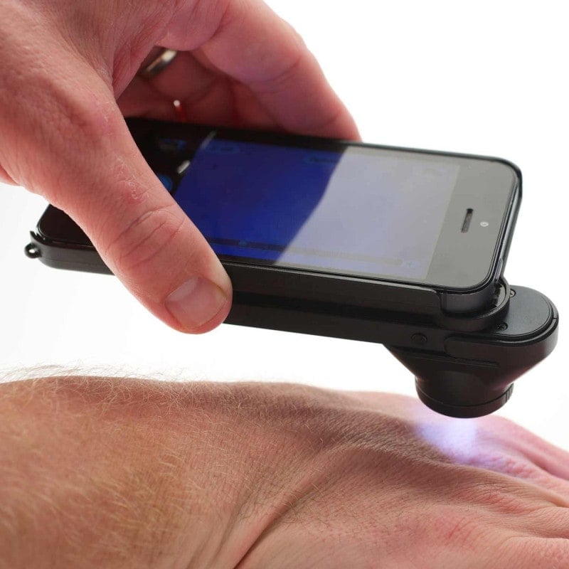 DermLite DL1 Medvana UK