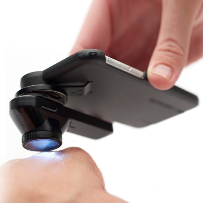 DermLite DL1 basic Medvana UK