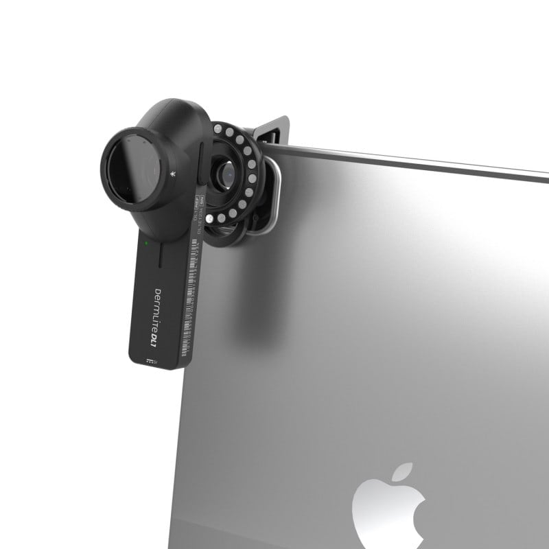 DermLite DL1 basic Medvana UK