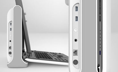 Chison EBit 60 Ultrasound System without ultrasound trolley Medvana UK