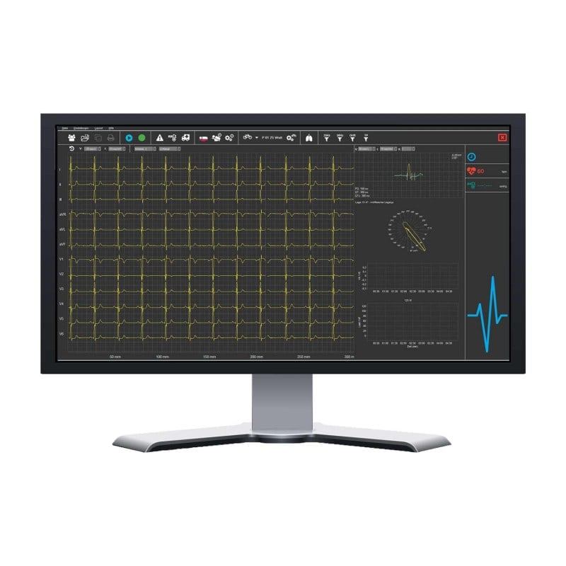 SmartScript PC-ECG System Bluetooth | Basic Medvana UK