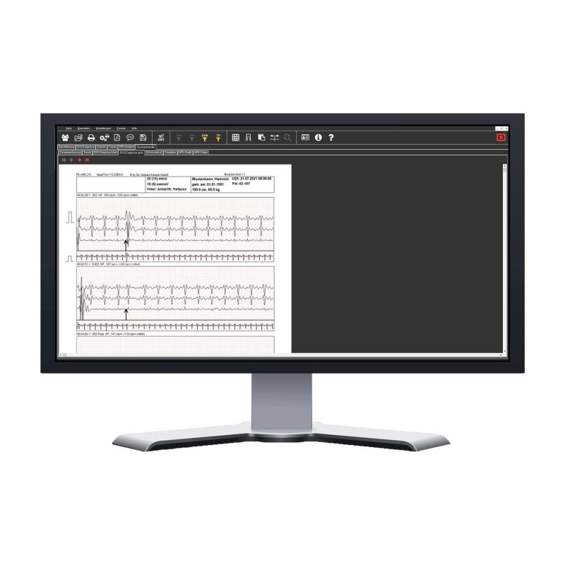 Kobold II Long-Term ECG Evaluation Package Medvana UK