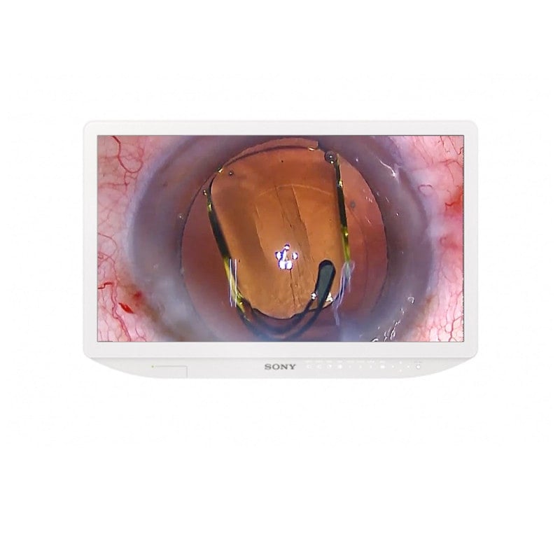 Sony LMD-2435MD 24IN Full HD 2D LCD Medical Monitor Medvana UK