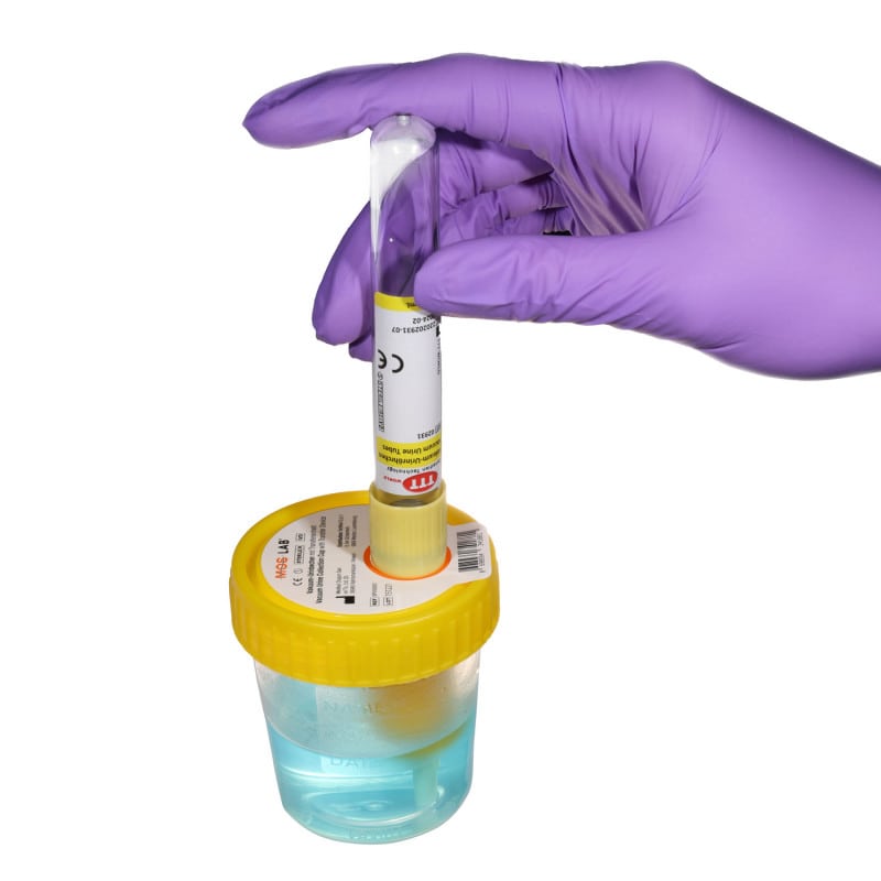 Vacuum Urine Tube Medvana UK