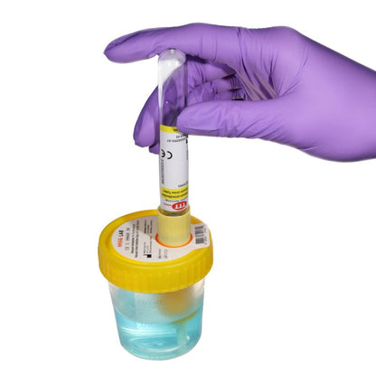 Vacuum Urine Tube Medvana UK