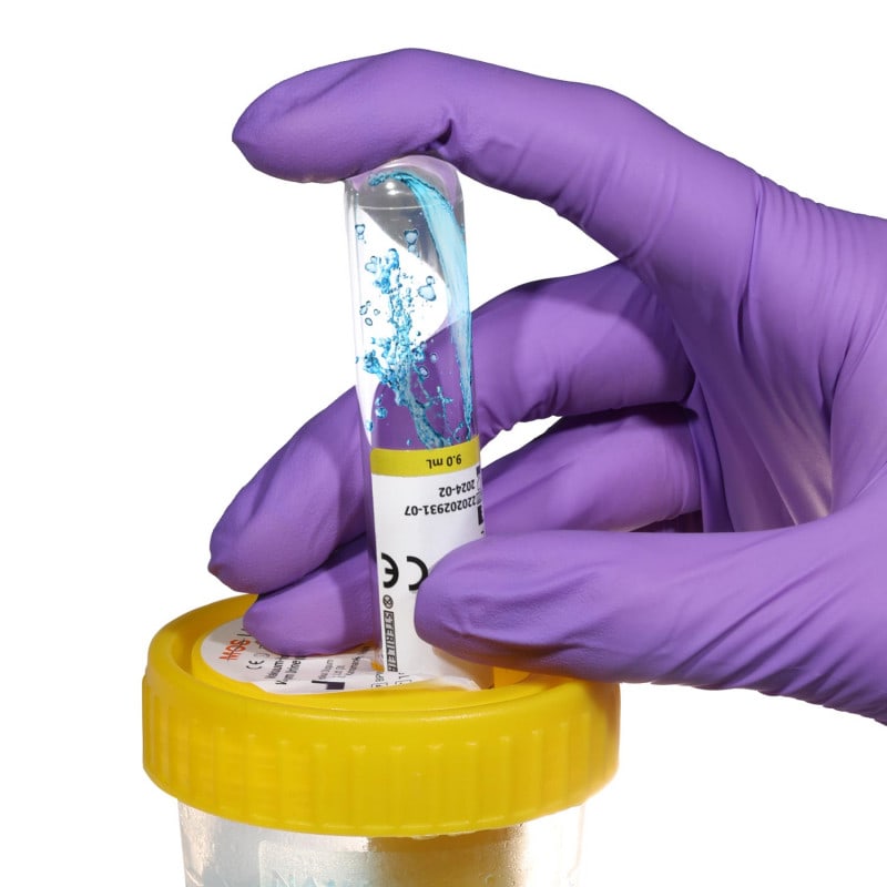 Urine Cup with Transfer Unit Medvana UK