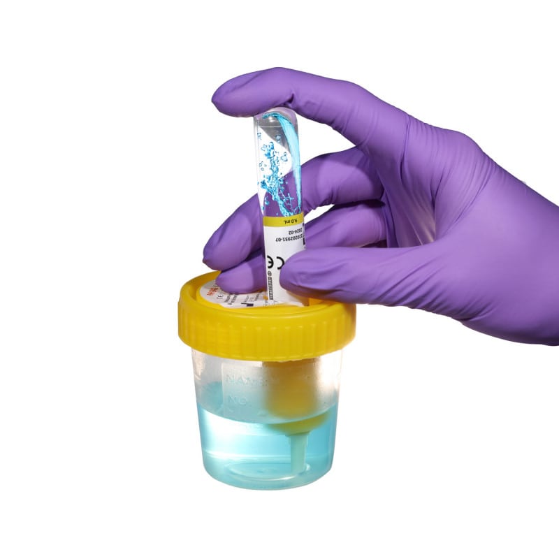 Vacuum Urine Tube Medvana UK