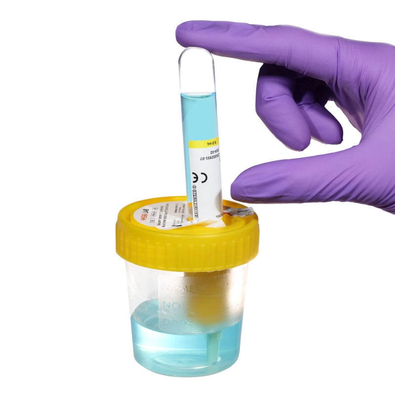 Urine Cup with Transfer Unit Medvana UK