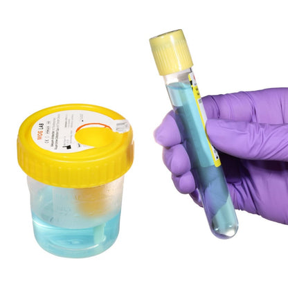 Urine Cup with Transfer Unit Medvana UK